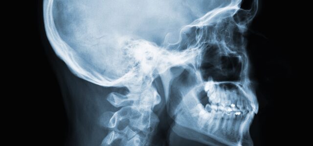 Cephalometric Radiography
