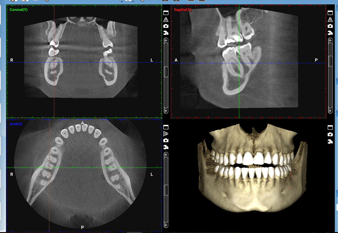 Cone-Beam Computed Tomography (CBCT)