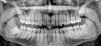 Panoramic Radiography